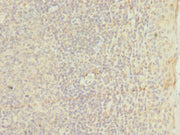 Immunohistochemistry of paraffin-embedded human tonsil tissue using CSB-PA023628ESR1HU at dilution of 1:100