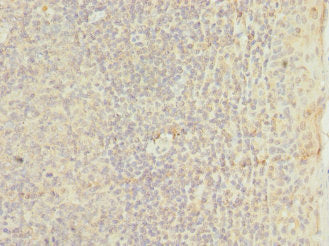 Immunohistochemistry of paraffin-embedded human tonsil tissue using CSB-PA023628ESR1HU at dilution of 1:100