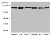 Western blot All lanes: TMCC1 antibody at 1µg/ml Lane 1: MCF-7 whole cell lysate Lane 2: Mouse liver tissue Lane 3: Mouse kidney tissue Lane 4: HL60 whole cell lysate Lane 5: K562 whole cell lysate Lane 6: U937 whole cell lysate Secondary Goat pol...