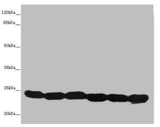 Western blot All lanes: TMED10 antibody at 4.88µg/ml Lane 1: Hela whole cell lysate Lane 2: Mouse liver tissue Lane 3: Mouse lung tissue Lane 4: 293T whole cell lysate Lane 5: NIH/3T3 whole cell lysate Lane 6: U87 whole cell lysate Secondary Goat...