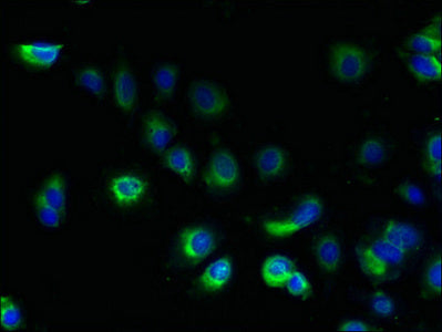 Immunofluorescent analysis of MCF-7 cells using CSB-PA023668LA01HU at dilution of 1:100 and Alexa Fluor 488-congugated AffiniPure Goat Anti-Rabbit IgG(H+L)