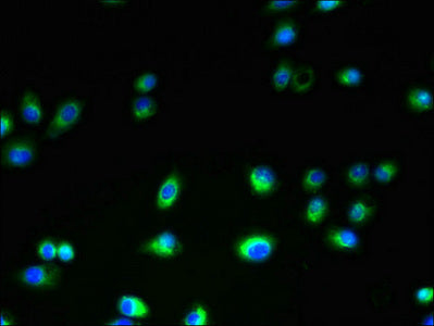 Immunofluorescent analysis of A2780 cells using CSB-PA023673LA01HU at dilution of 1:100 and Alexa Fluor 488-congugated AffiniPure Goat Anti-Rabbit IgG(H+L)