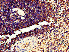 Immunohistochemistry of paraffin-embedded human spleen tissue using CSB-PA023679LA01HU at dilution of 1:100