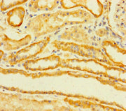 Immunohistochemistry of paraffin-embedded human kidney tissue using CSB-PA023688LA01HU at dilution of 1:100