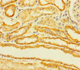 Immunohistochemistry of paraffin-embedded human kidney tissue using CSB-PA023688LA01HU at dilution of 1:100