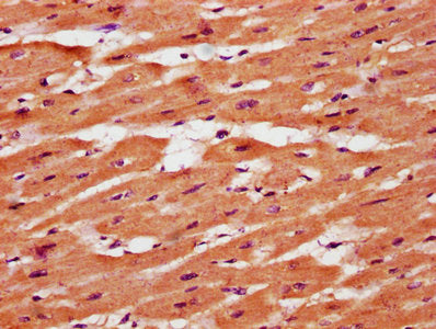 IHC image of CSB-PA023694LA01HU diluted at 1:400 and staining in paraffin-embedded human heart tissue performed on a Leica BondTM system. After dewaxing and hydration, antigen retrieval was mediated by high pressure in a citrate buffer (pH 6.0). S...