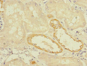 Immunohistochemistry of paraffin-embedded human kidney tissue using CSB-PA023709LA01HU at dilution of 1:100
