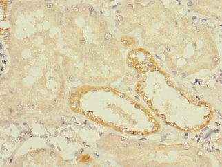 Immunohistochemistry of paraffin-embedded human kidney tissue using CSB-PA023709LA01HU at dilution of 1:100