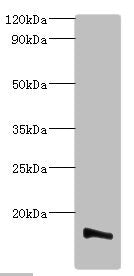 Western blot All lanes: Transmembrane protein 14B antibody at 2ug/ml + K562 whole cell lysate Secondary Goat polyclonal to rabbit IgG at 1/10000 dilution Predicted band size: 13, 9 kDa Observed band size: 13 kDa