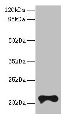 Western blot All lanes: TMEM154 antibody at 6µg/ml + MCF-7 whole cell lysate Secondary Goat polyclonal to rabbit IgG at 1/10000 dilution Predicted band size: 21 kDa Observed band size: 21 kDa