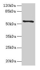 Western blot All lanes: TMEM161A antibody at 1µg/ml + PC-3 whole cell lysate Secondary Goat polyclonal to rabbit IgG at 1/10000 dilution Predicted band size: 54, 42 kDa Observed band size: 54 kDa