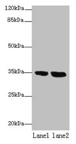Western blot All lanes: TMEM165 antibody at 8µg/ml Lane 1: Jurkat whole cell lysate Lane 2: Hela whole cell lysate Secondary Goat polyclonal to rabbit IgG at 1/10000 dilution Predicted band size: 35, 29 kDa Observed band size: 35 kDa