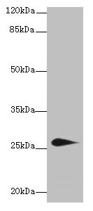 Western blot All lanes: TMEM174 antibody at 0.8µg/ml + Mouse kidney tissue Secondary Goat polyclonal to rabbit IgG at 1/10000 dilution Predicted band size: 27, 24 kDa Observed band size: 27 kDa