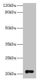 Western blot All lanes: GM2A antibody at 2µg/ml + Rat kidney tissue Secondary Goat polyclonal to rabbit IgG at 1/10000 dilution Predicted band size: 21 kDa Observed band size: 21 kDa
