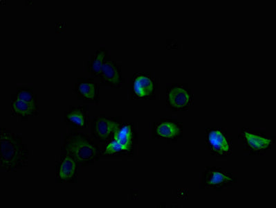 Immunofluorescent analysis of MCF-7 cells using CSB-PA023770LA01HU at dilution of 1:100 and Alexa Fluor 488-congugated AffiniPure Goat Anti-Rabbit IgG(H+L)