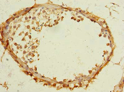 Immunohistochemistry of paraffin-embedded human testis tissue using CSB-PA023774LA01HU at dilution of 1:100