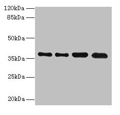 Western blot All lanes: TMEM19 antibody at 1µg/ml Lane 1: MCF-7 whole cell lysate Lane 2: U251 whole cell lysate Lane 3: Mouse stomach tissue Lane 4: A549 whole cell lysate Secondary Goat polyclonal to rabbit IgG at 1/10000 dilution Predicted band...