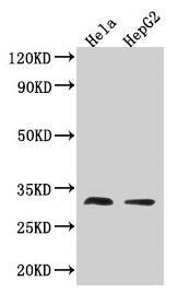 Western Blot Positive WB detected in: Hela whole cell lysate, HepG2 whole cell lysate All lanes: TMEM192 antibody at 3.2µg/ml Secondary Goat polyclonal to rabbit IgG at 1/50000 dilution Predicted band size: 31 kDa Observed band size: 31 kDa