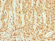 Immunohistochemistry of paraffin-embedded human adrenal gland tissue using CSB-PA023799LA01HU at dilution of 1:100
