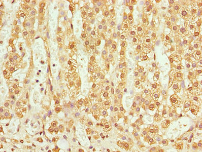 Immunohistochemistry of paraffin-embedded human adrenal gland tissue using CSB-PA023799LA01HU at dilution of 1:100
