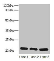 Western blot All lanes: GM2A antibody at 10µg/ml Lane 1: Rat liver tissue Lane 2: Mouse stomach tissue Lane 3: Mouse small intestine tissue Secondary Goat polyclonal to rabbit IgG at 1/10000 dilution Predicted band size: 21 kDa Observed band size:...