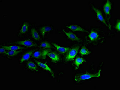 Immunofluorescent analysis of Hela cells using CSB-PA023801LA01HU at dilution of 1:100 and Alexa Fluor 488-congugated AffiniPure Goat Anti-Rabbit IgG(H+L)