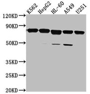 Western Blot Positive WB detected in: K562 whole cell lysate, HepG2 whole cell lysate, HL-60 whole cell lysate, A549 whole cell lysate, U251 whole cell lysate All lanes: TMEM214 antibody at 1:2000 Secondary Goat polyclonal to rabbit IgG at 1/50000...