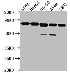 Western Blot Positive WB detected in: K562 whole cell lysate, HepG2 whole cell lysate, HL-60 whole cell lysate, A549 whole cell lysate, U251 whole cell lysate All lanes: TMEM214 antibody at 1:2000 Secondary Goat polyclonal to rabbit IgG at 1/50000...