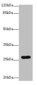 Western blot All lanes: TMEM217 antibody at 10µg/ml + Jurkat whole cell lysate Secondary Goat polyclonal to rabbit IgG at 1/10000 dilution Predicted band size: 27, 25 kDa Observed band size: 27 kDa