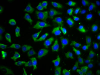Immunofluorescence staining of A549 cells with CSB-PA023822LA01HU at 1:100, counter-stained with DAPI. The cells were fixed in 4% formaldehyde, permeabilized using 0.2% Triton X-100 and blocked in 10% normal Goat Serum. The cells were then incubat...