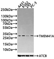 Western Blot Positive WB detected in: A431 whole cell lysate(30µg), K562 whole cell lysate(30µg), 293 whole cell lysate(30µg), PC-3 whole cell lysate(30µg) All lanes: TMEM41A antibody at 1:1000 Secondary Goat polyclonal to rabbit IgG at 1/20000 di...