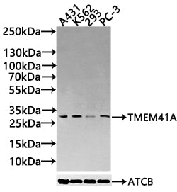 Western Blot Positive WB detected in: A431 whole cell lysate(30µg), K562 whole cell lysate(30µg), 293 whole cell lysate(30µg), PC-3 whole cell lysate(30µg) All lanes: TMEM41A antibody at 1:1000 Secondary Goat polyclonal to rabbit IgG at 1/20000 di...