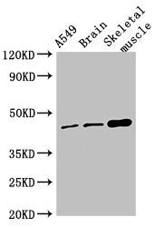 Western Blot Positive WB detected in: A549 whole cell lysate, Mouse brain tissue, Mouse skeletal muscle tissue All lanes: TMEM43 antibody at 4µg/ml Secondary Goat polyclonal to rabbit IgG at 1/50000 dilution Predicted band size: 45 kDa Observed ba...