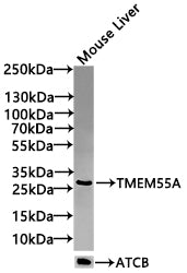 Western Blot Positive WB detected in:Mouse Liver tissue lysate(30µg) All lanes: TMEM55A antibody at 1:1000 Secondary Goat polyclonal to rabbit IgG at 1/20000 dilution Predicted band size: 29 kDa Observed band size: 29 kDa Exposure time: 120s