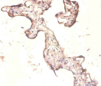 Immunohistochemistry of paraffin-embedded human placenta tissue using CSB-PA02385A0Rb at dilution of 1:100