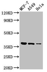 Western Blot Positive WB detected in: MCF-7 whole cell lysate, A549 whole cell lysate, Hela whole cell lysate All lanes: TMEM59 antibody at 3µg/ml Secondary Goat polyclonal to rabbit IgG at 1/50000 dilution Predicted band size: 37 kDa Observed ban...