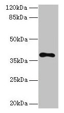 Western blot All lanes: TMEM59L antibody at 3µg/ml + 293T whole cell lysate Secondary Goat polyclonal to rabbit IgG at 1/10000 dilution Predicted band size: 38 kDa Observed band size: 38 kDa