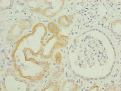 Immunohistochemistry of paraffin-embedded human kidney tissue using CSB-PA023863LA01HU at dilution of 1:100