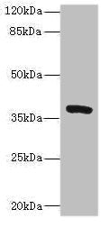 Western blot All lanes: TMEM64 antibody at 8µg/ml + Mouse brain tissue Secondary Goat polyclonal to rabbit IgG at 1/10000 dilution Predicted band size: 40, 13, 15, 34 kDa Observed band size: 40 kDa