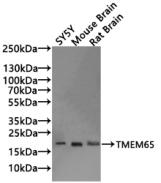 Western blot Positive WB detected in: PC-3 whole cell lysate, Hela whole cell lysate, MCF-7 whole cell lysate, 293 whole cell lysate, SH-SY5Y whole cell lysate, Mouse brain tissue All lanes: TMEM65 antibody at 1:1000 Secondary Goat polyclonal to r...