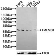 Western Blot Positive WB detected in: K562 whole cell lysate(30µg), JK whole cell lysate(30µg), Hela whole cell lysate(30µg), PC-3 whole cell lysate(30µg), HT29 whole cell lysate(30µg) All lanes: TMEM68 antibody at 1:1000 Secondary Goat polyclonal...