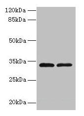 Western blot All lanes: TMEM71 antibody at 0.2µg/ml Lane 1: U937 whole cell lysate Lane 2: U87 whole cell lysate Secondary Goat polyclonal to rabbit IgG at 1/10000 dilution Predicted band size: 33, 31, 27 kDa Observed band size: 33 kDa