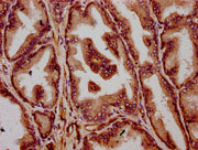 IHC image of CSB-PA023881LA01HU diluted at 1:300 and staining in paraffin-embedded human prostate tissue performed on a Leica BondTM system. After dewaxing and hydration, antigen retrieval was mediated by high pressure in a citrate buffer (pH 6.0)...