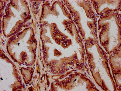 IHC image of CSB-PA023881LA01HU diluted at 1:300 and staining in paraffin-embedded human prostate tissue performed on a Leica BondTM system. After dewaxing and hydration, antigen retrieval was mediated by high pressure in a citrate buffer (pH 6.0)...