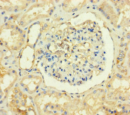 Immunohistochemistry of paraffin-embedded human kidney tissue using CSB-PA023885LA01HU at dilution of 1:100