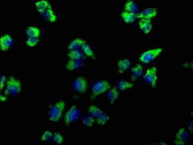 Immunofluorescence staining of Hela cells with CSB-PA023887OA01HU at 1:66, counter-stained with DAPI. The cells were fixed in 4% formaldehyde, permeabilized using 0.2% Triton X-100 and blocked in 10% normal Goat Serum. The cells were then incubate...