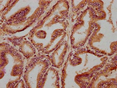 IHC image of CSB-PA023891LA01HU diluted at 1:400 and staining in paraffin-embedded human prostate tissue performed on a Leica BondTM system. After dewaxing and hydration, antigen retrieval was mediated by high pressure in a citrate buffer (pH 6.0)...