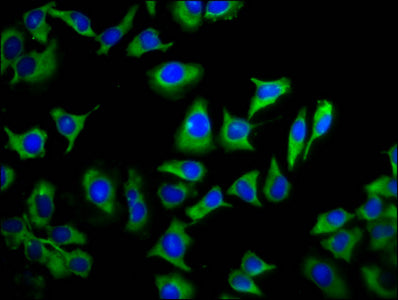 Immunofluorescence staining of A549 cells with CSB-PA023892LA01HU at 1:133, counter-stained with DAPI. The cells were fixed in 4% formaldehyde, permeabilized using 0.2% Triton X-100 and blocked in 10% normal Goat Serum. The cells were then incubat...