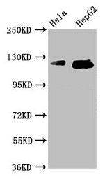 Western Blot Positive WB detected in: Hela whole cell lysate, HepG2 whole cell lysate All lanes: TMF1 antibody at 3.7µg/ml Secondary Goat polyclonal to rabbit IgG at 1/50000 dilution Predicted band size: 123, 124 kDa Observed band size: 123, 124 kDa