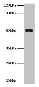 Western blot All lanes: TMLHE antibody at 2µg/ml + MCF-7 whole cell lysate Secondary Goat polyclonal to rabbit IgG at 1/10000 dilution Predicted band size: 50, 47, 39, 45, 43, 42, 51 kDa Observed band size: 50 kDa